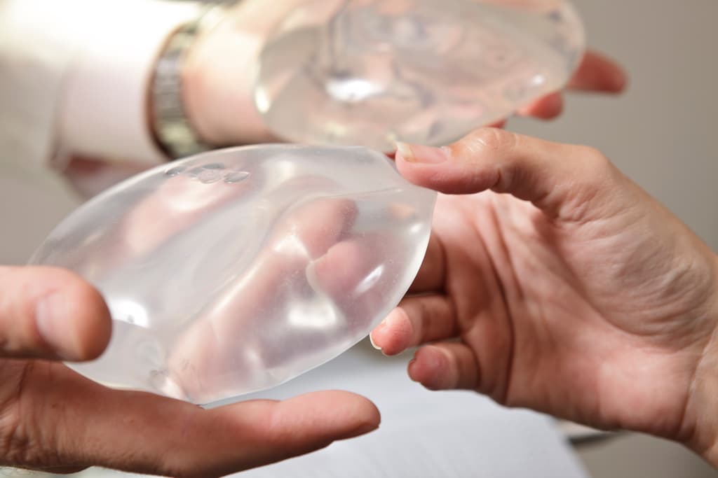 Understanding Breast Implant Illness