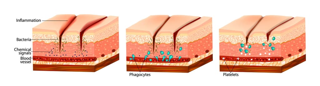 Wound healing & swelling diagram