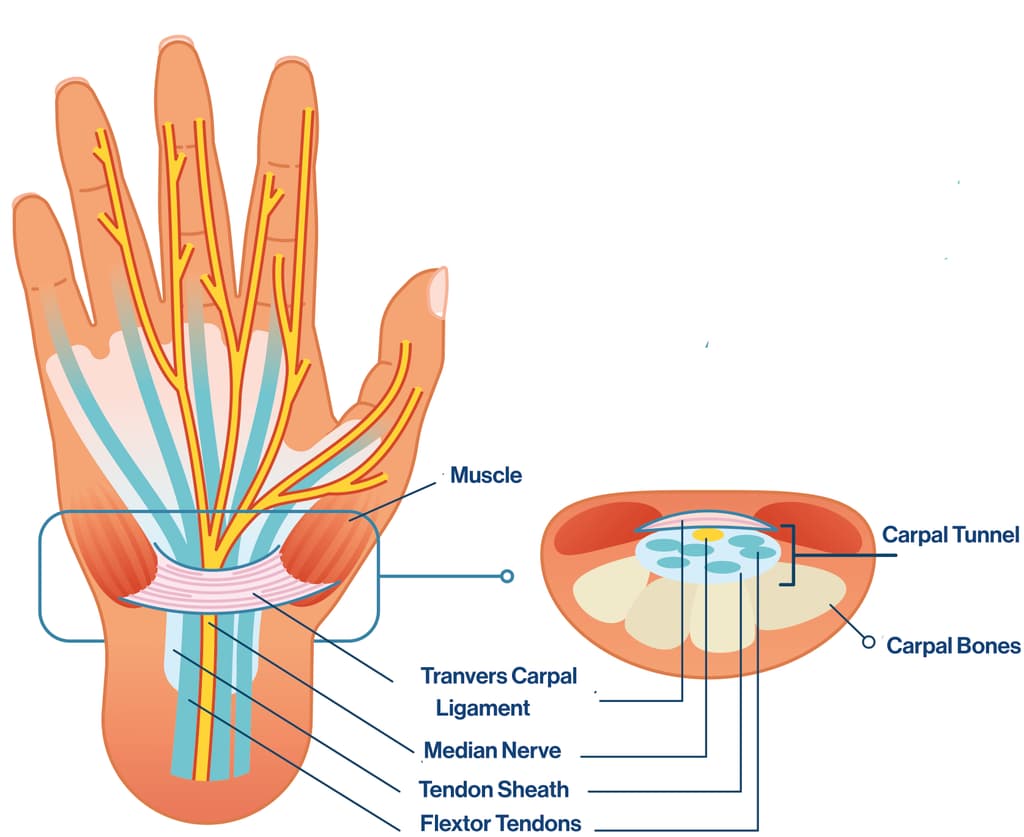 Carpal tunnel diagram