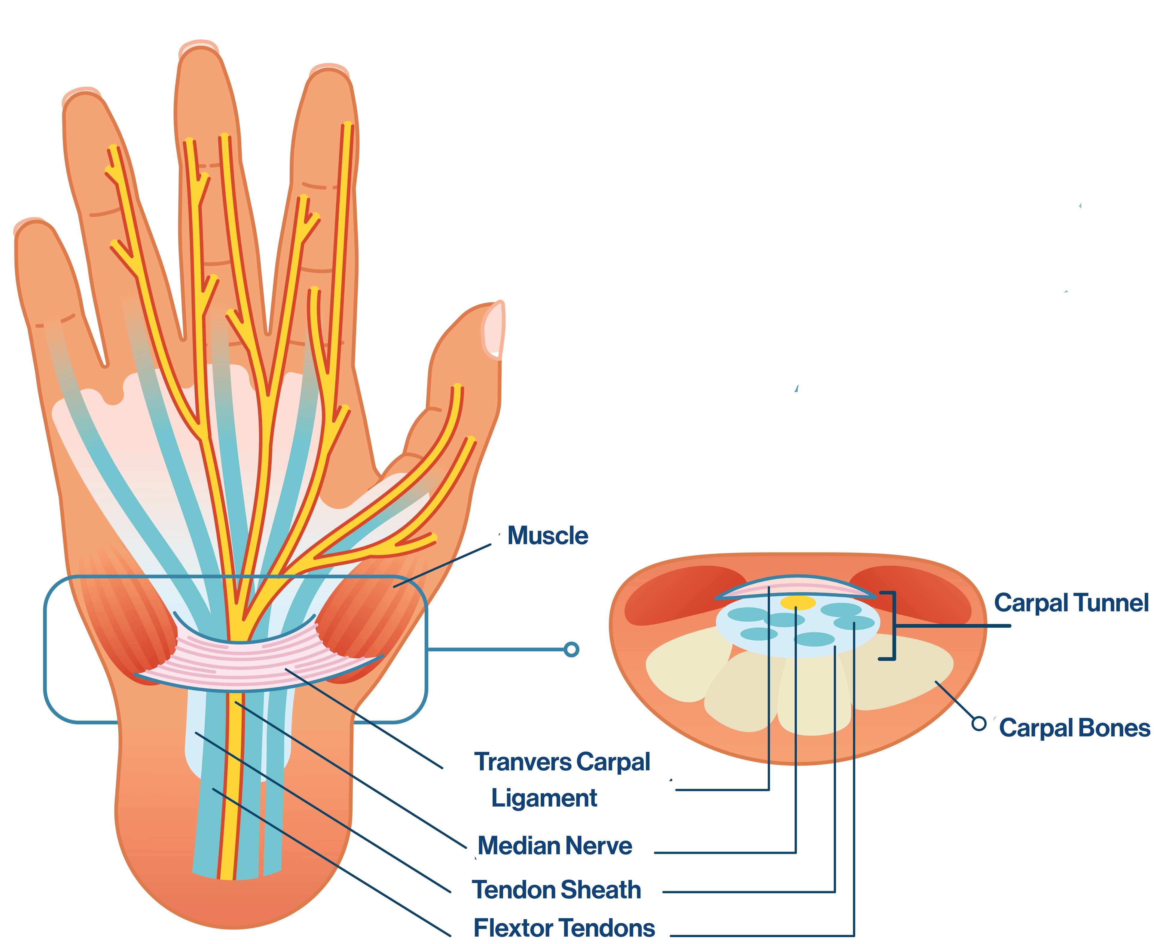 Carpal tunnel diagram